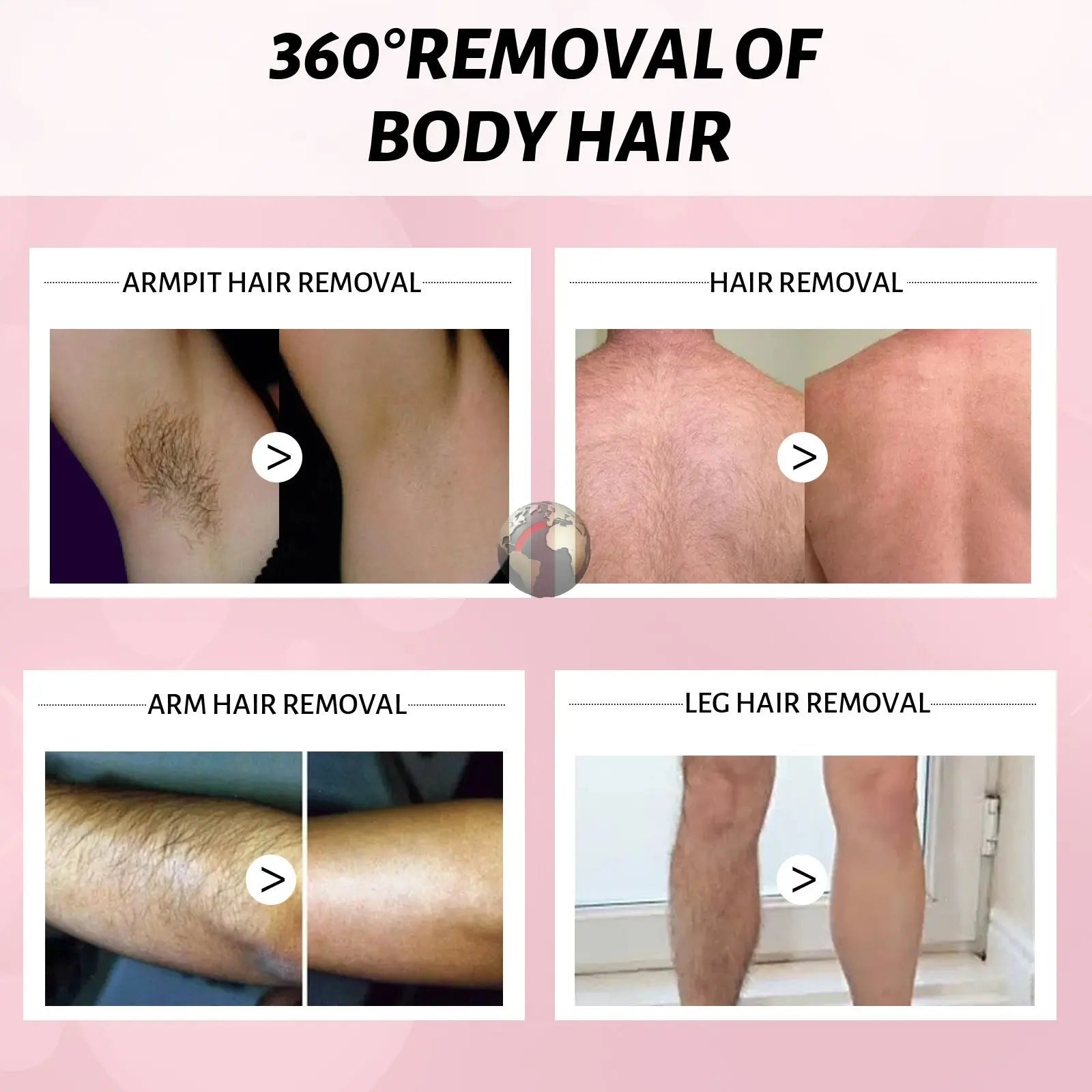 30ml/100ml Body Hair Removal Spray Non - irritating - Mode Fashion