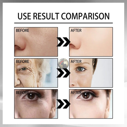 Anti - aging wrinkle lines restoration cream - Mode Fashion