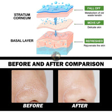 Bamboo Charcoal Blackhead Removal Rip - Off Mask - Mode Fashion