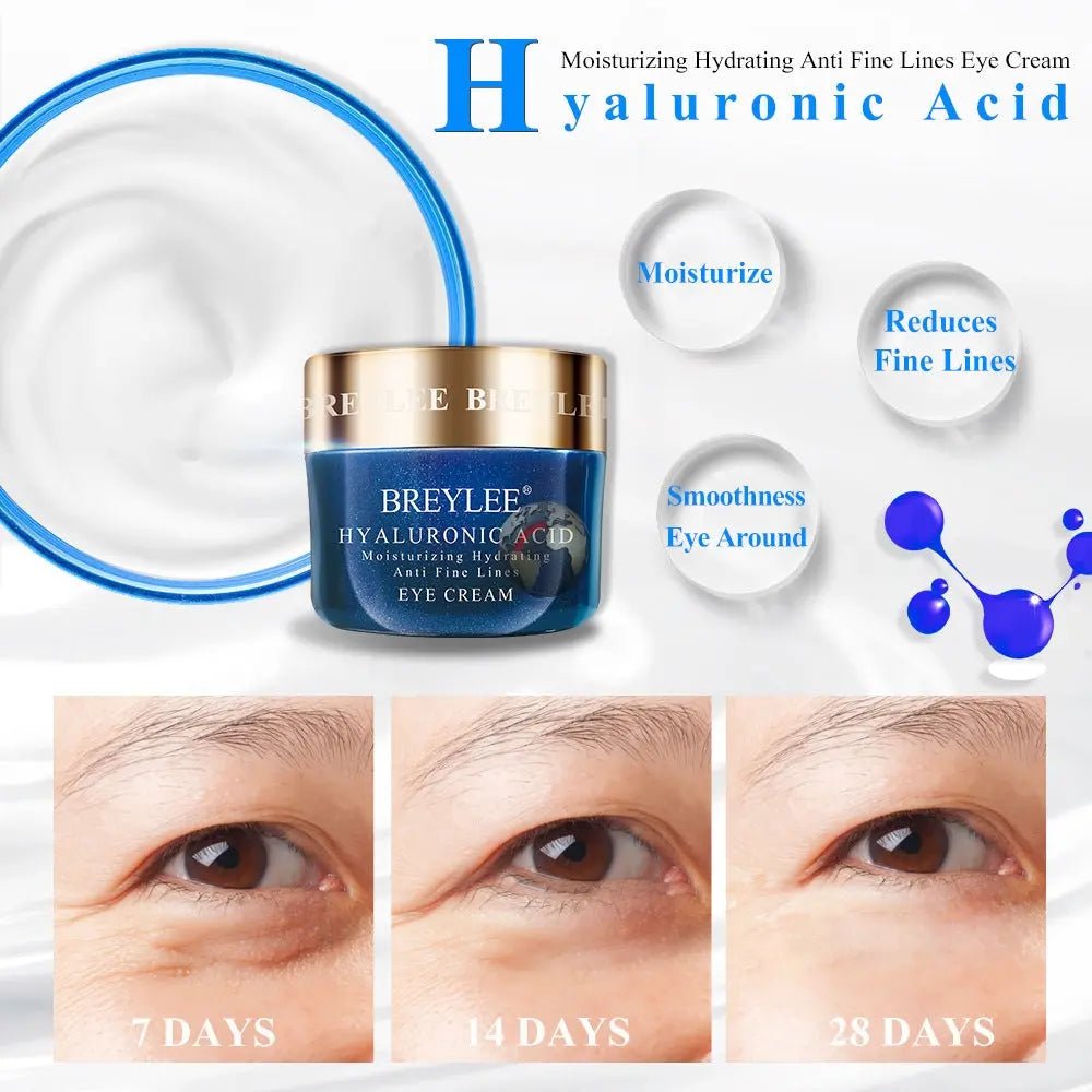 Nourishing and Moisturizing Eye Cream - Mode Fashion